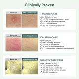 Arocell Cica Repair Panthenol Mask - 4pcs