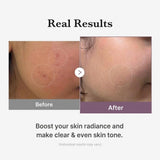 Medicube Age-R Glutathione Glow Toner 140ml
