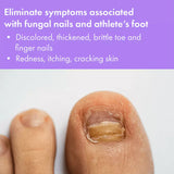 Vite20 Antifungal Brush-On Solution 0.50oz