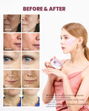 KSECRET Retinol Advanced Regenerating Eye Gel Patches