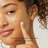 COSRX Acne Pimple Master - 24 patches